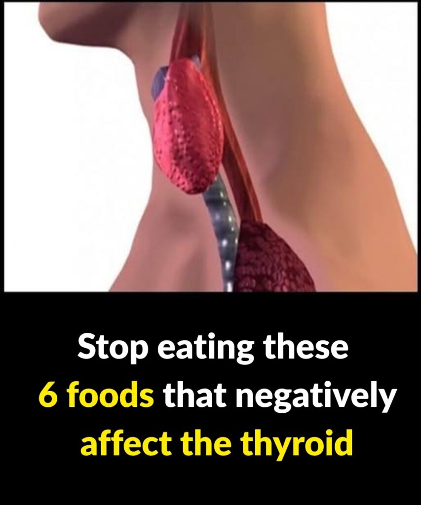 6 Foods That Can Harm Your Thyroid Health