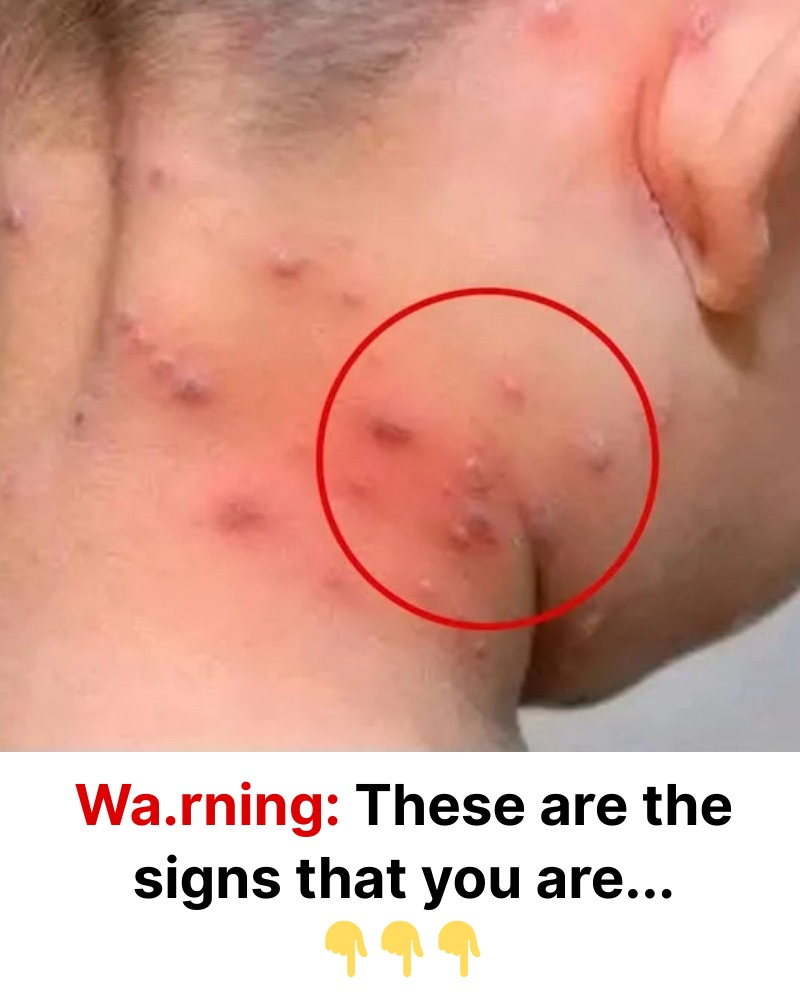 Do you know the main types of skin rashes? Find out what they are and what causes them