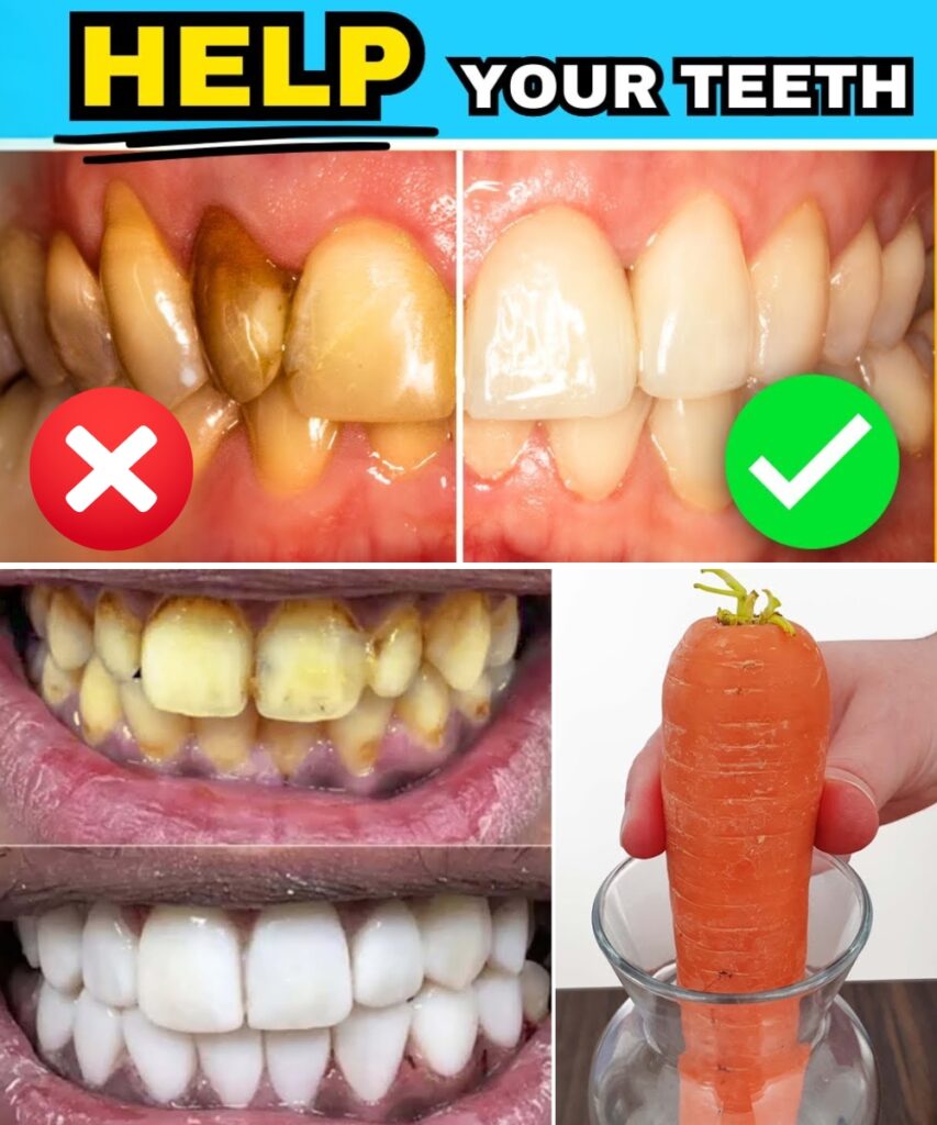 How to Whiten Your Teeth Fast with Carrots – Stained Yellow Teeth Turn Bright in Just 2 Minutes!