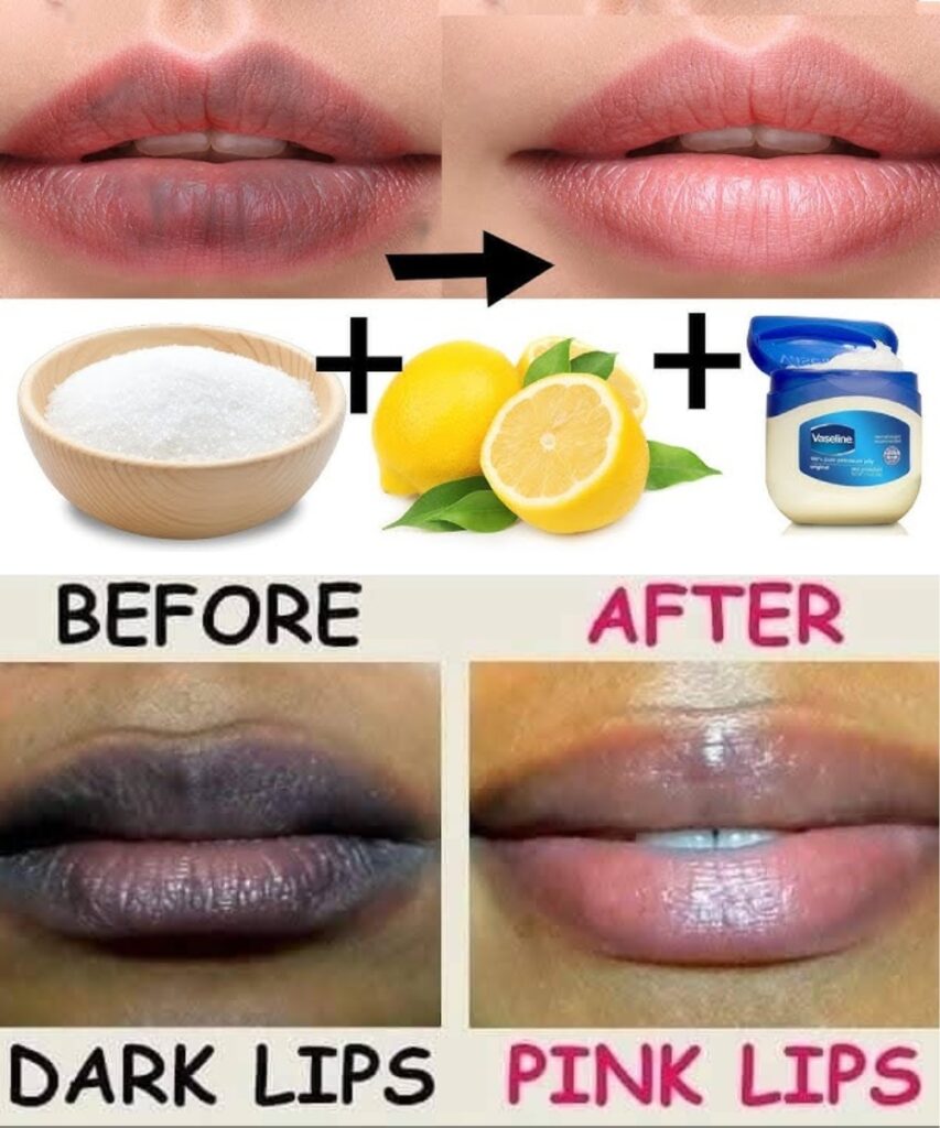 Tired of Dry, Dark, or Chapped Lips? This Simple DIY Trick Might Be All You Need 