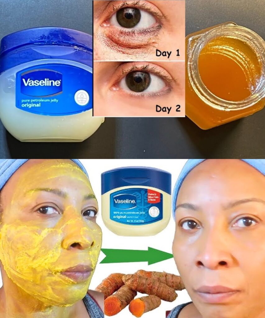 Vaseline Beauty Hacks: 11 Gentle Ways to Transform Your Skin & Hair Naturally