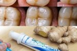 How to Naturally Repair a Cavity and Strengthen Your Teeth