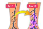 5 best drinks for peripheral neuropathy & chronic pain relief