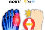 The #1 drink to reverse High URIC ACID and GOUT!