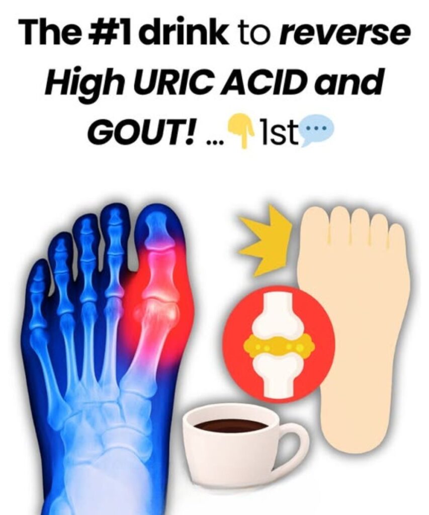 The #1 drink to reverse High URIC ACID and GOUT!