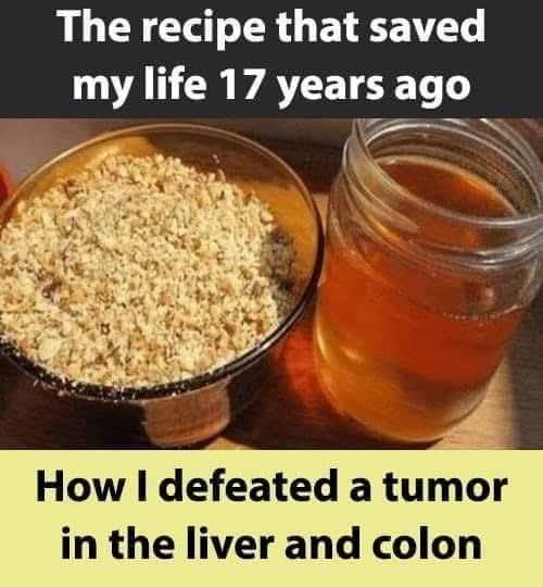 I Overcame Liver and Colon Tumors 17 Years Ago With This Recipe