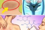 8 Signs That Indicate You Have Too Much Sugar