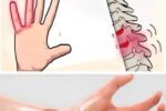 Hand Numbness: Normal or a Sign of a Problem?