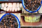Chewing Cloves Daily: The Tiny Spice with Big Oral Health Benefits