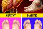 12 Ways Your Feet Are Warning you About Your Liver!