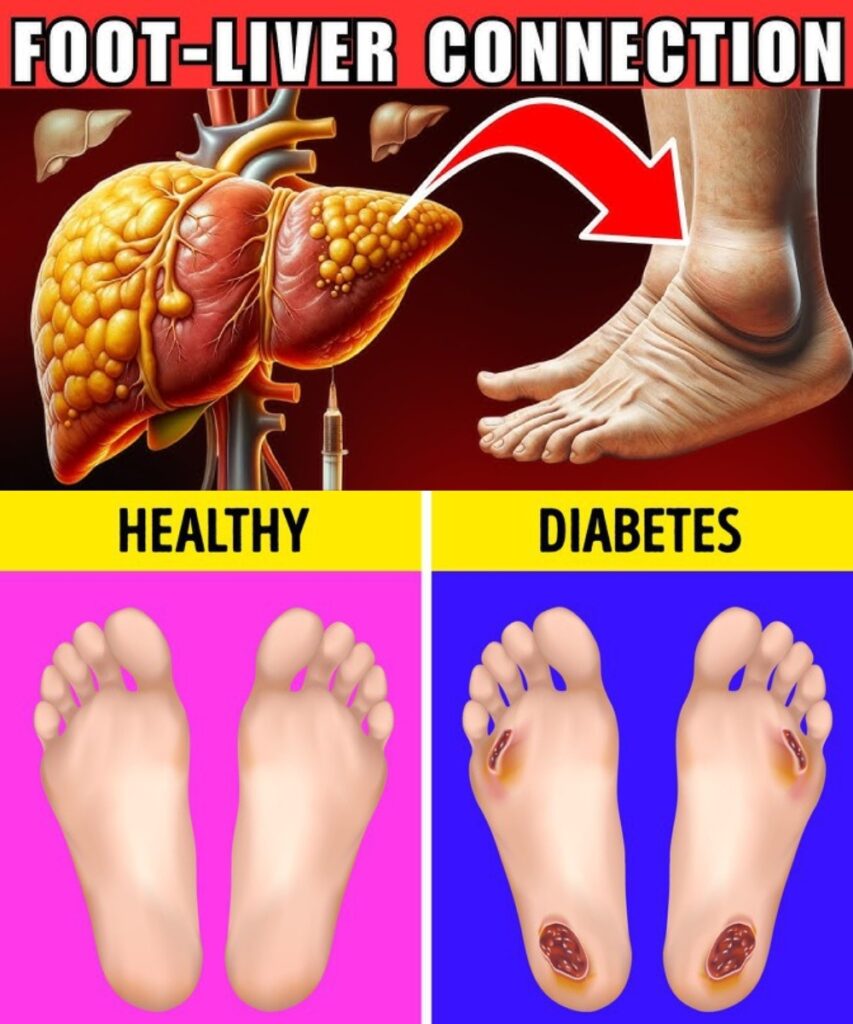 12 Ways Your Feet Are Warning you About Your Liver!