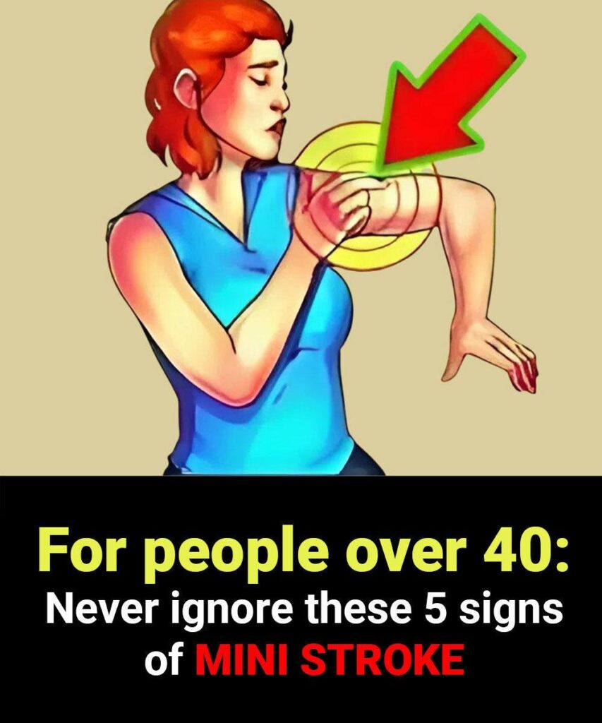 Mini Stroke in People Over 40: What You Need to Know