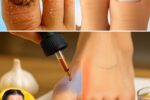 Natural Ways to Support Healthy Toenails — Gentle Care for a Common Problem