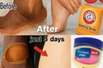 How to Naturally Lighten Dark Inner Thighs, Underarms, Hands, and Legs with This Simple DIY Remedy