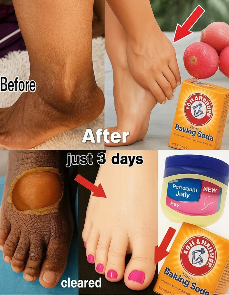 How to Naturally Lighten Dark Inner Thighs, Underarms, Hands, and Legs with This Simple DIY Remedy