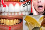 6 Natural Ways to Brighten Your Smile — No Dentist Required! 😁