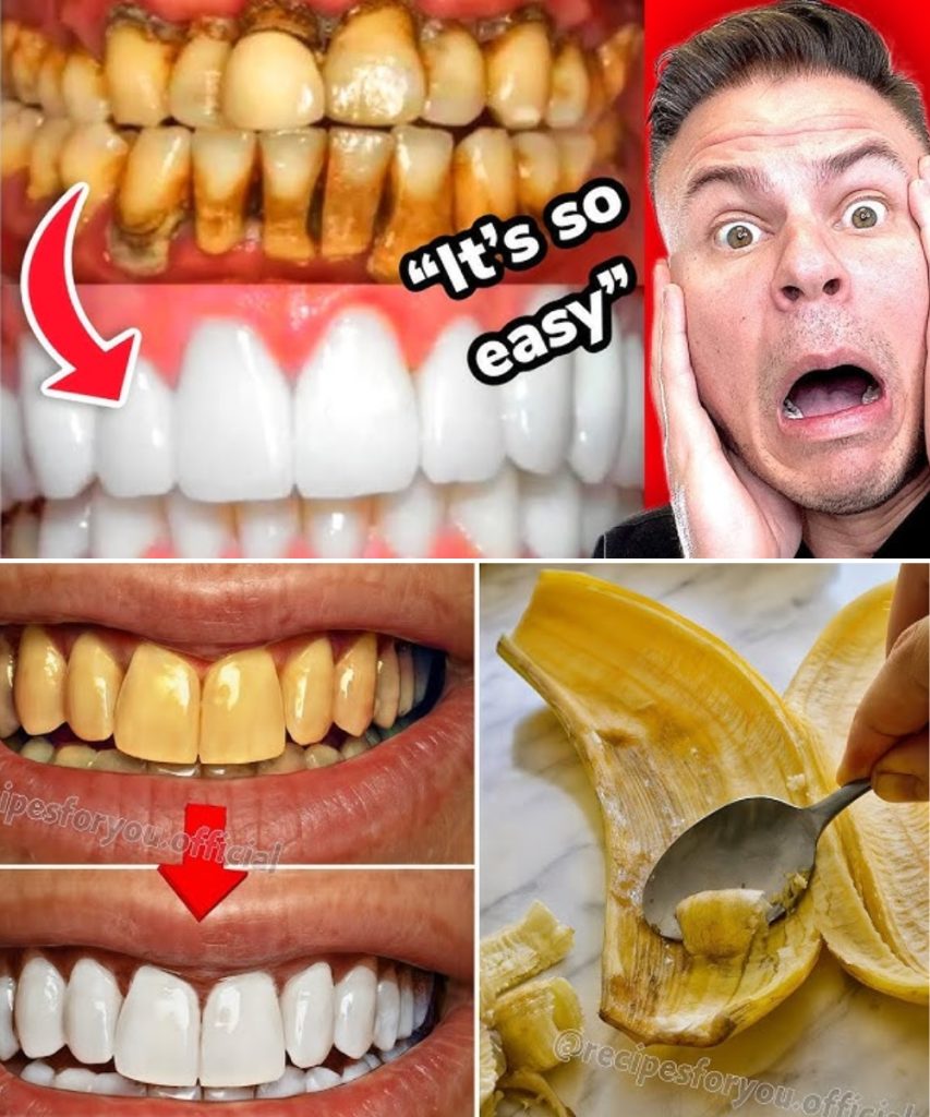 6 Natural Ways to Brighten Your Smile — No Dentist Required! 😁