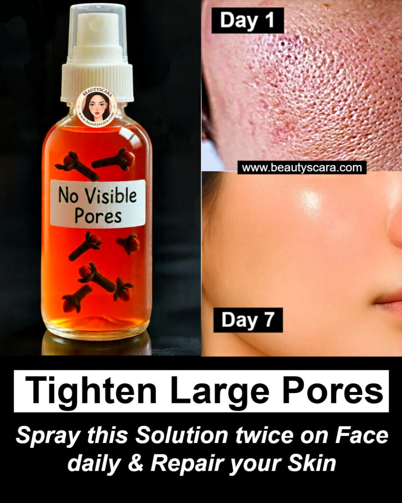 Clove benefits for Skin – Clove Oil, Clove Gel & Clove ice cubes 