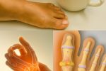 The Herbal Tea That May Help Reduce Swollen Legs and Ankles