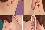 What That Swollen Lump Near Your Neck or Ear Really Means – And When to Worry