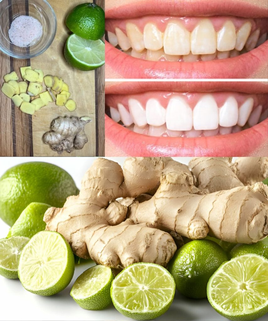 Brighten Your Smile Naturally with Ginger and Salt