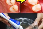 Natural Ways to Strengthen Your Teeth and Protect Against Cavities