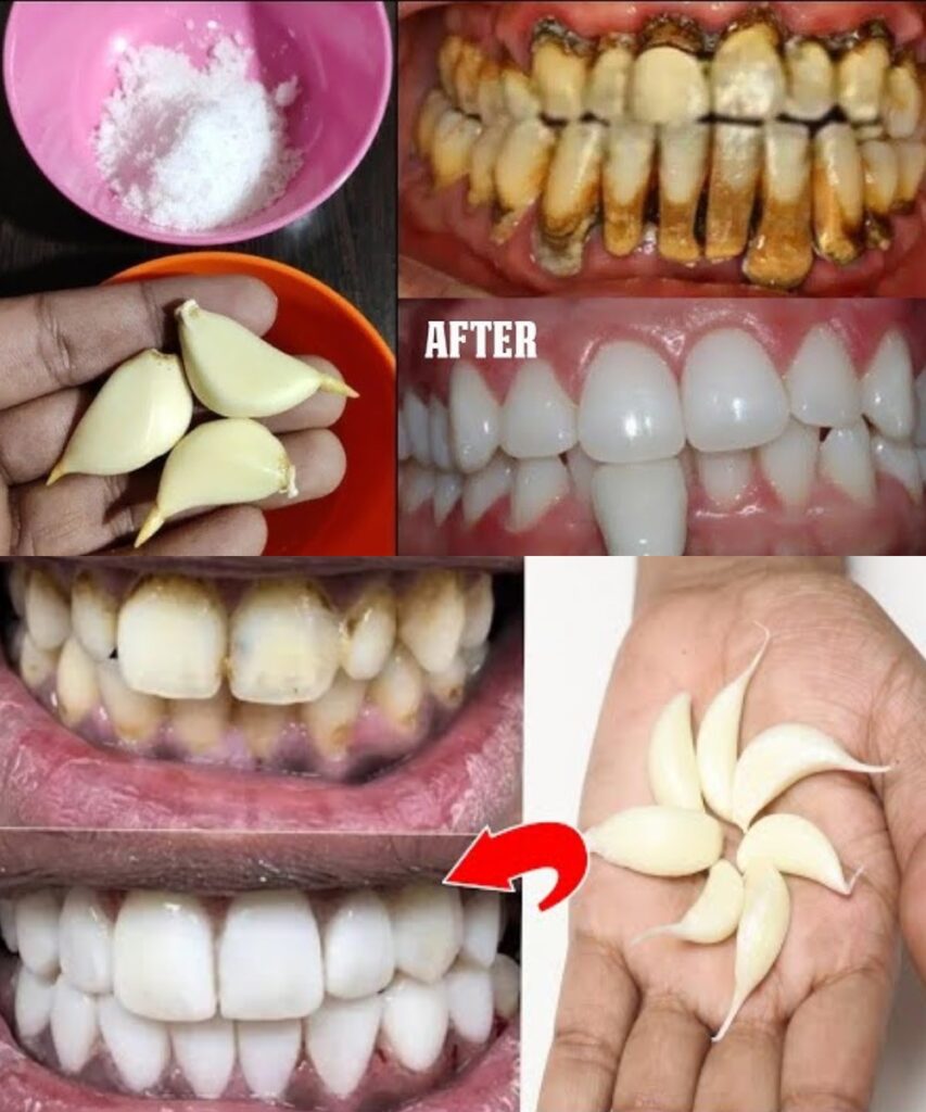 7 Natural Teeth Whitening Secrets for a Brighter Smile