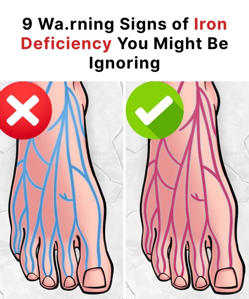 9 Warning Signs of Iron Deficiency You Might Be Ignoring