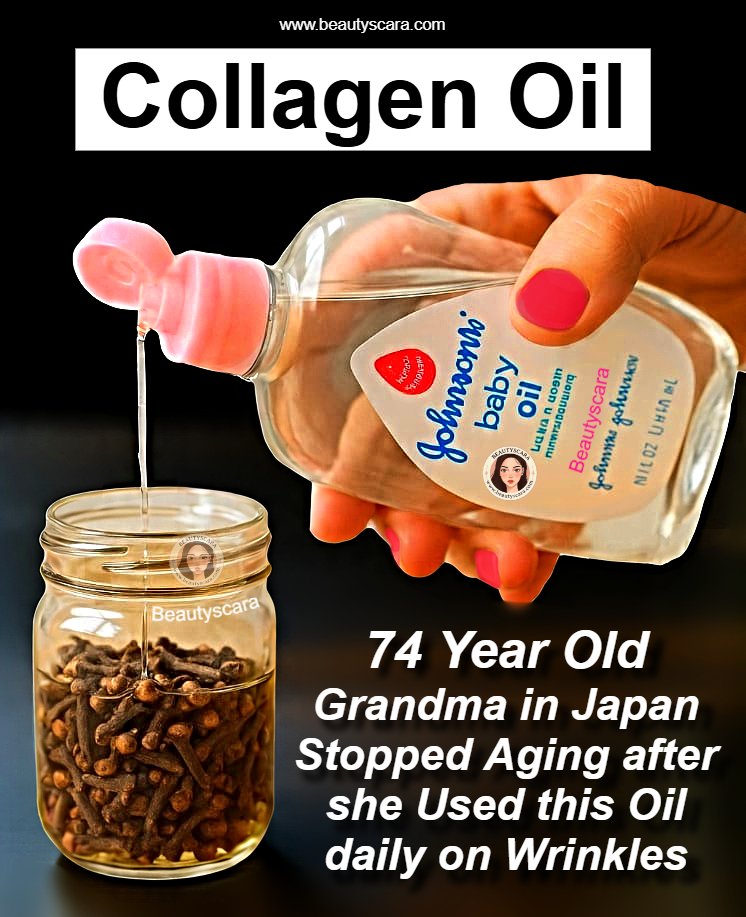 Clove benefits for Skin – Clove Oil, Clove Gel & Clove ice cubes 