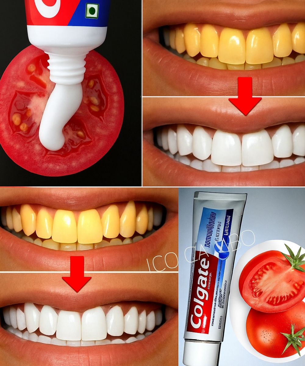 Say Goodbye to Yellow Teeth with This Simple Kitchen Recipe