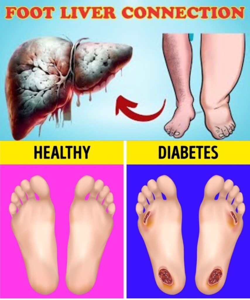 👣 12 Subtle Signs in Your Feet That Could Point to Liver Trouble (Don’t Ignore These!)