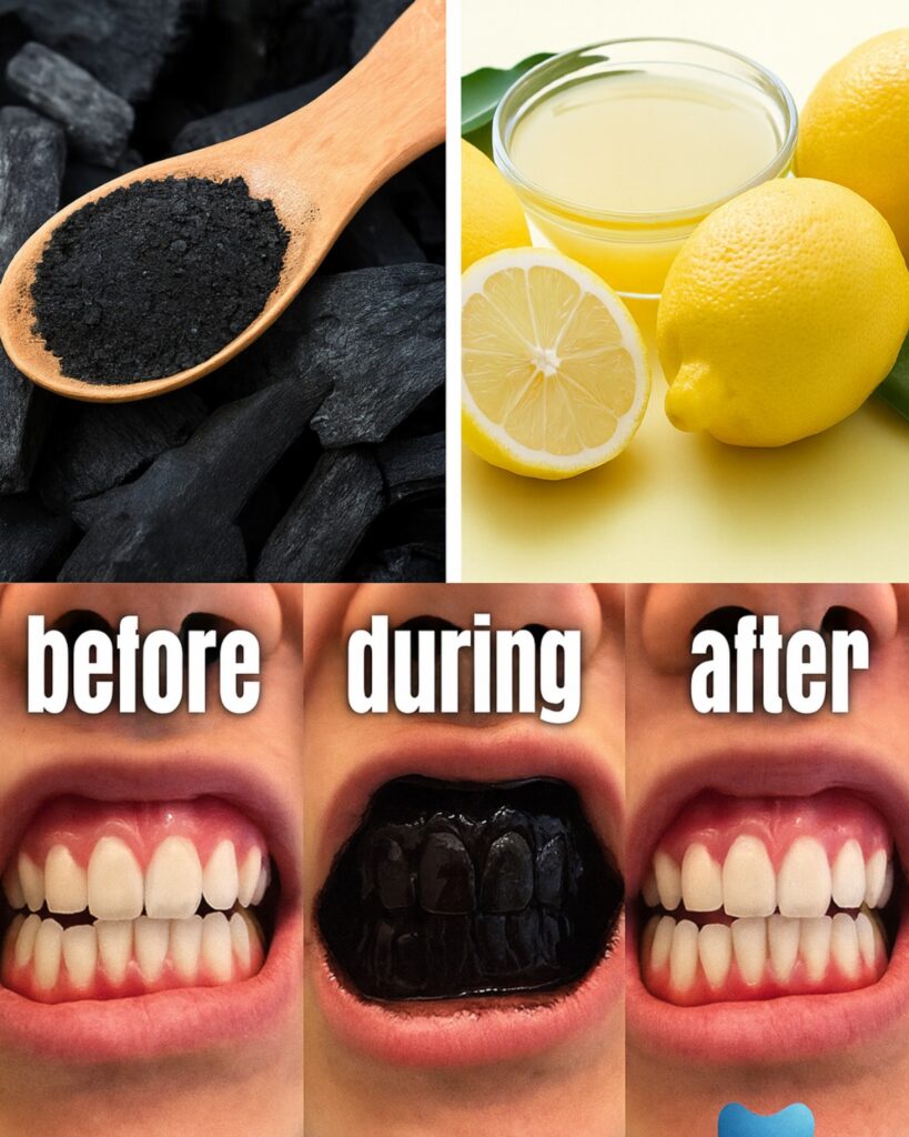 Can Charcoal and Lemon Really Heal Cavities Naturally?