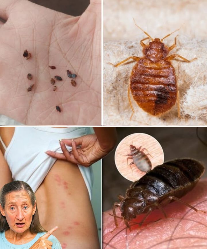 Bedbugs Will Disappear from Your Garden in Minutes by Doing This (Natural & Safe Tip!)