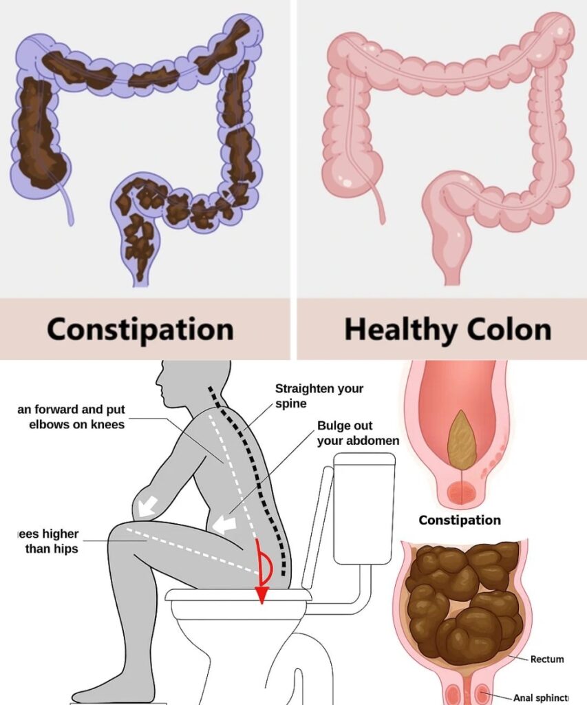 Learn How to Clean 13 Kilograms of Waste from Your Colon in One Night