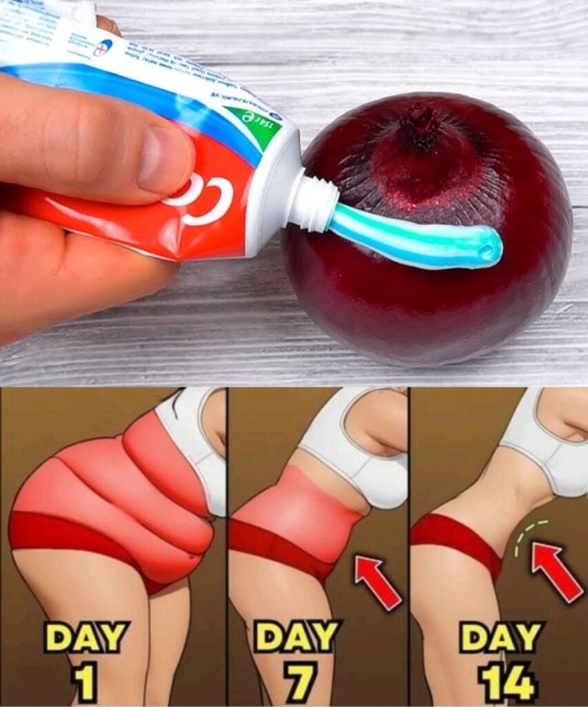 Lose Belly Fat Overnight: Onion + Toothpaste