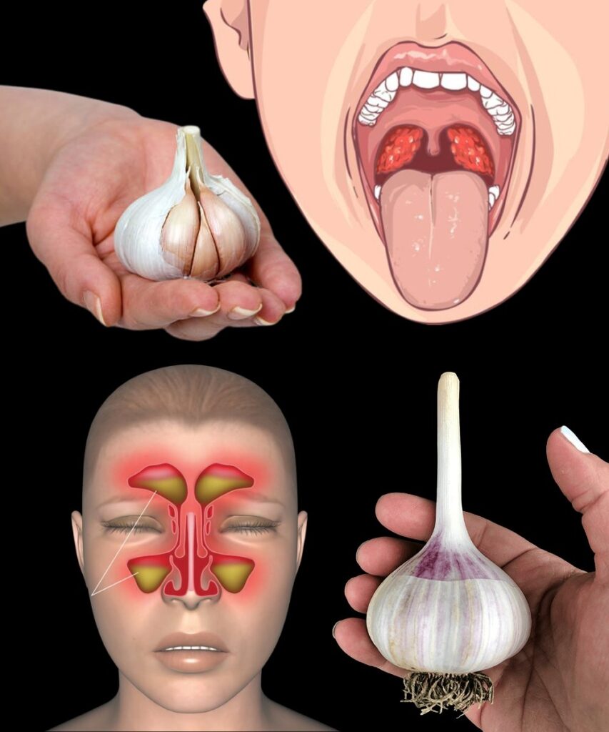 Garlic Destroys Urinary System Infections! Just Do This…