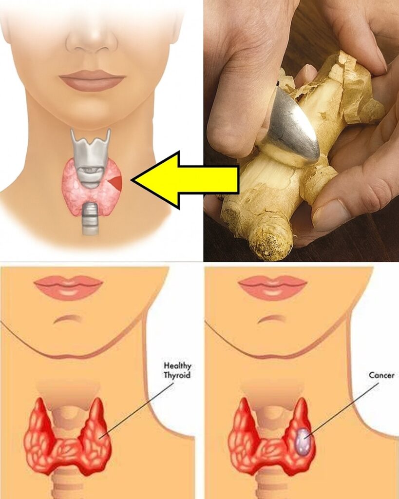 19 Foods to Avoid with Thyroid Problems