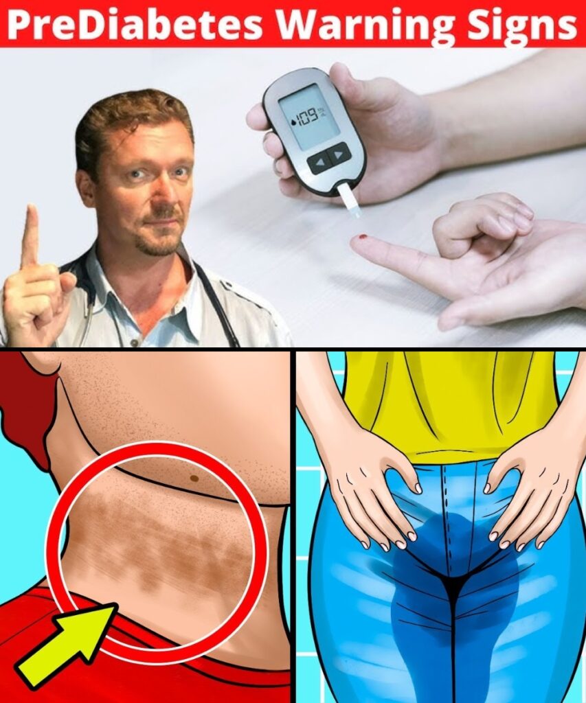 12 Signs You May Have Prediabetes, How to Detect It, and How to Control It