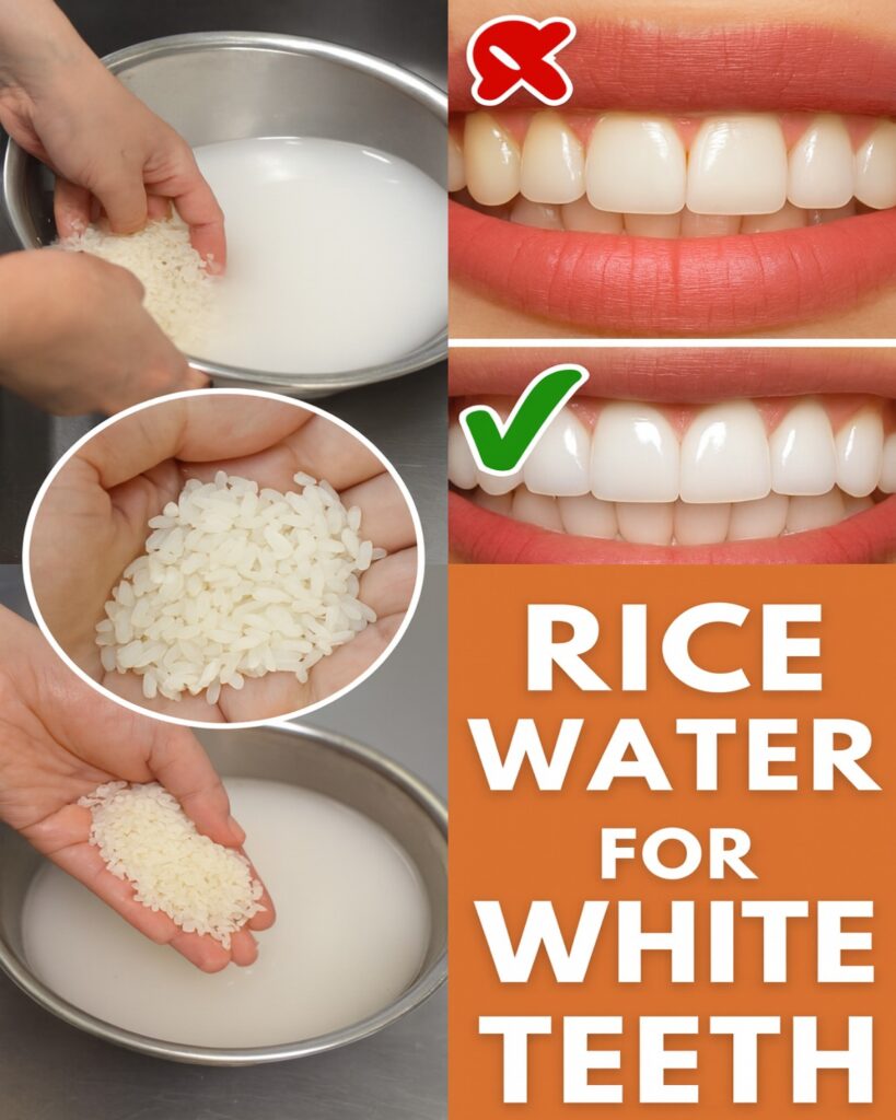 Rice Water for Teeth Whitening: Natural Remedy or Just a Myth?