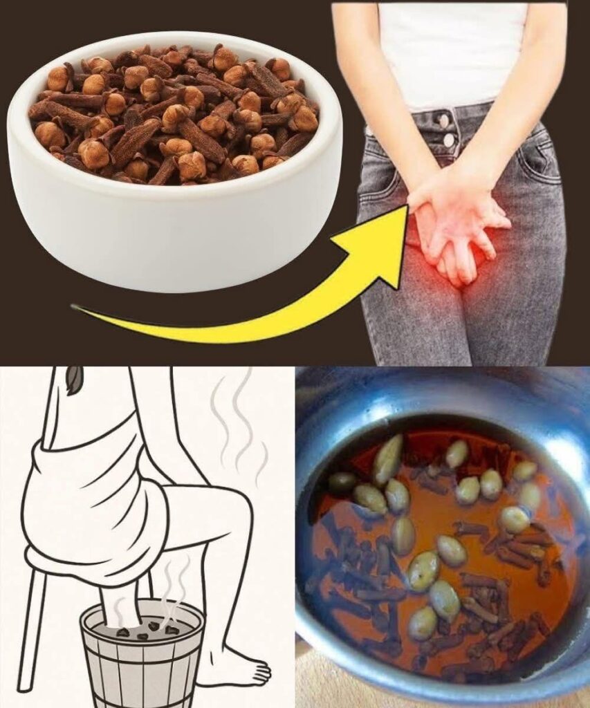 11 Incredible Clove Benefits Every Woman Should Know