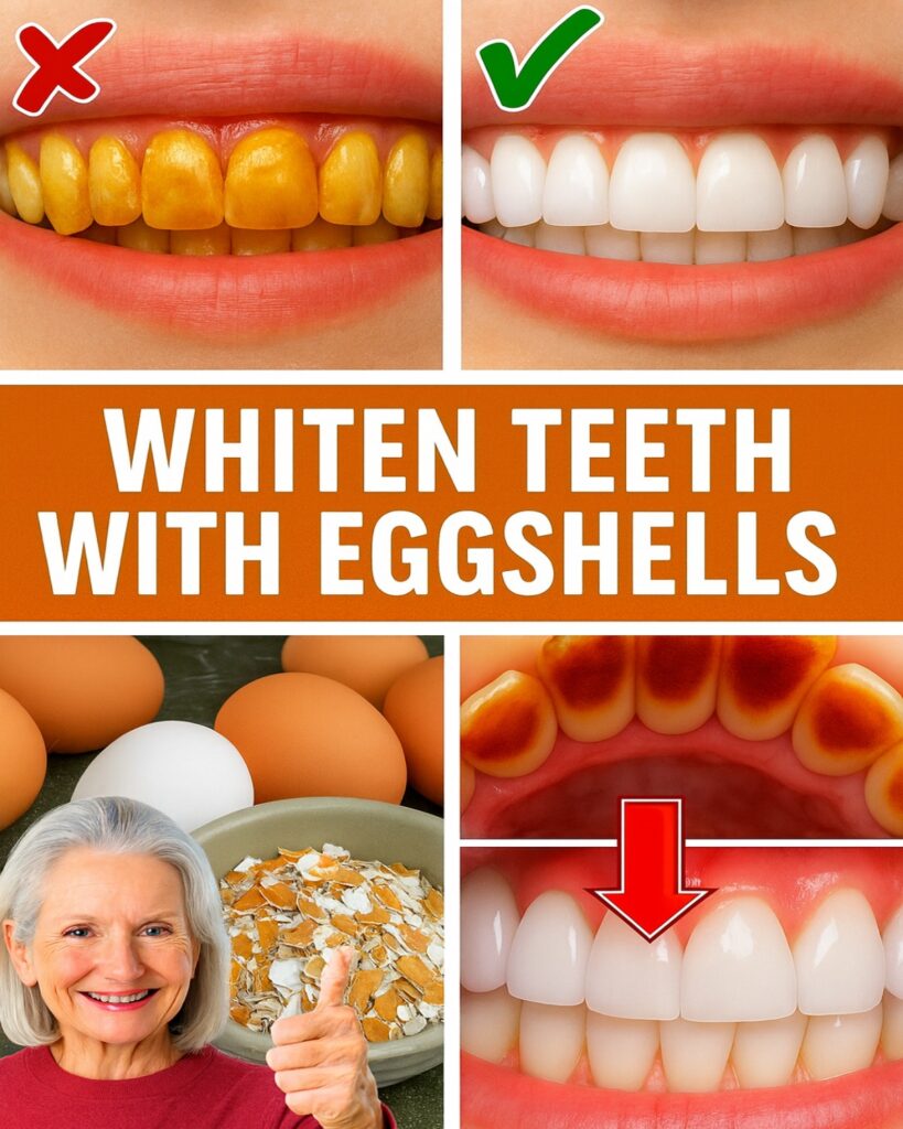 Transform Yellow Teeth Into a Brighter Smile Naturally