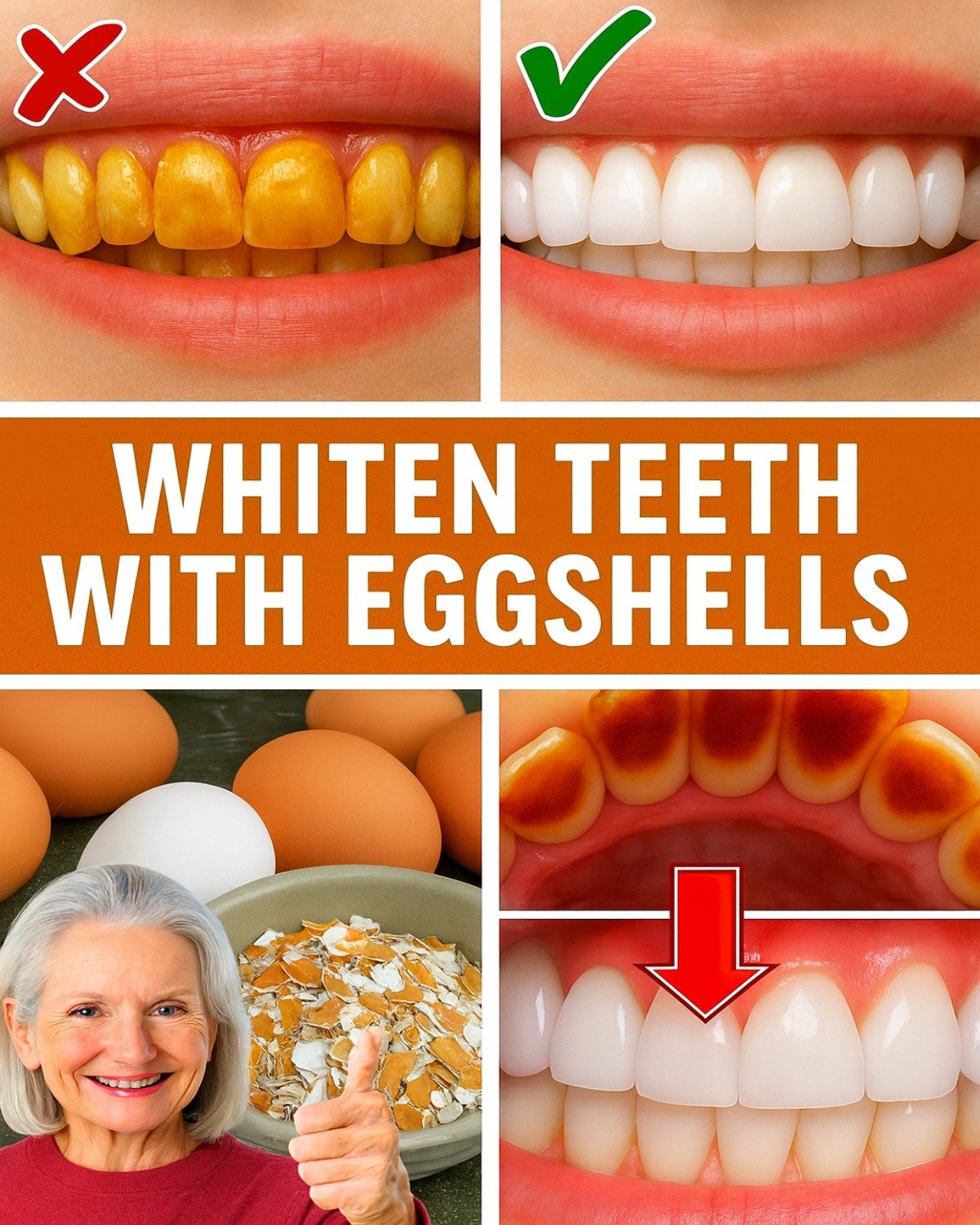 Transform Yellow Teeth Into a Brighter Smile Naturally