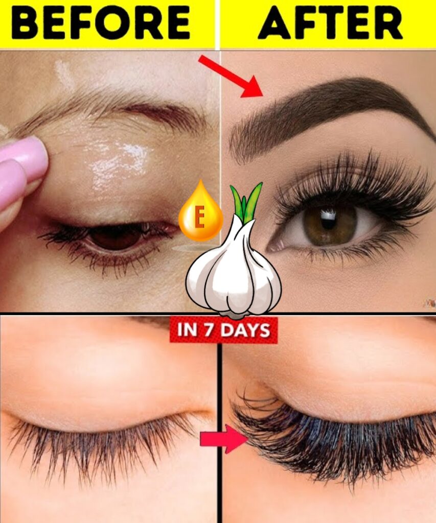 How to Grow Thicker Eyebrows and Longer Eyelashes Naturally with Garlic and Vitamin E