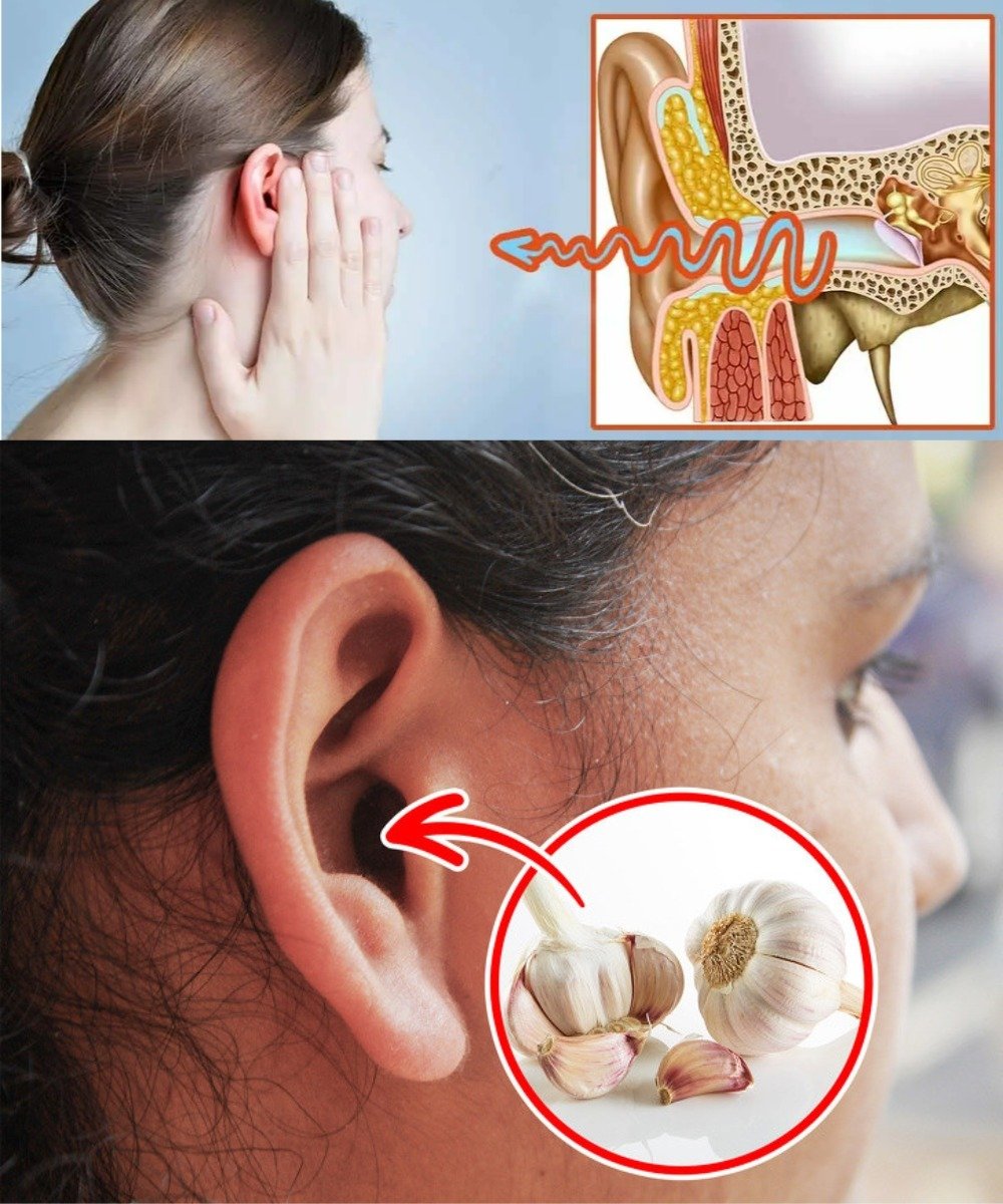 Garlic: Your Natural Ally for Ear Health 🌿🧄