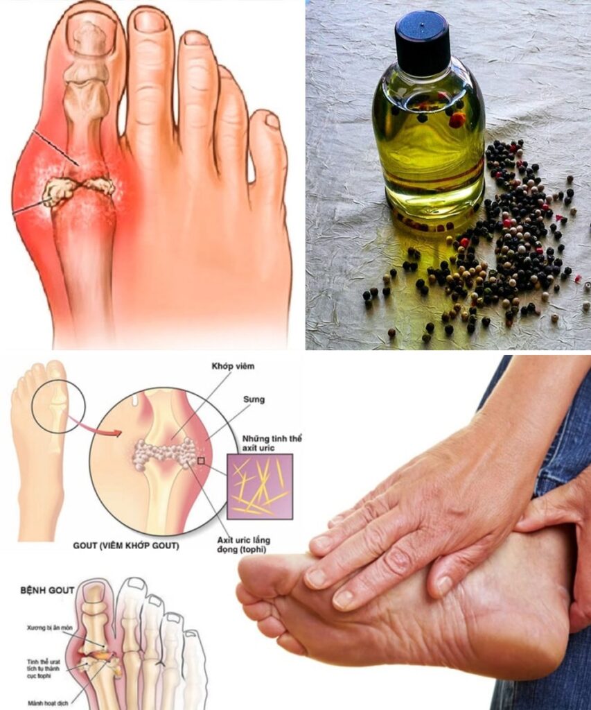 This Oil Quickly Eliminates Uric Acid, Inflammation, Joint Pain, Smoking Cravings, and More