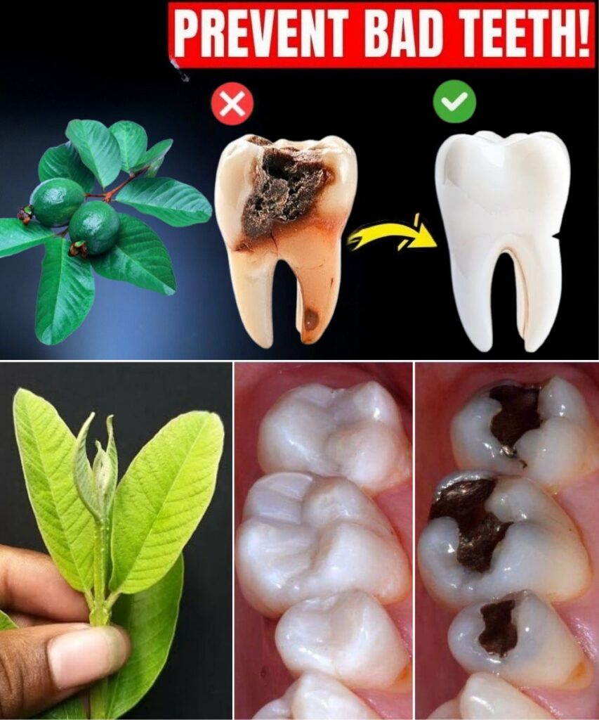 Top 3 Ways to Treat Tooth Decay with Guava Leaves – Simple and Cost-Effective
