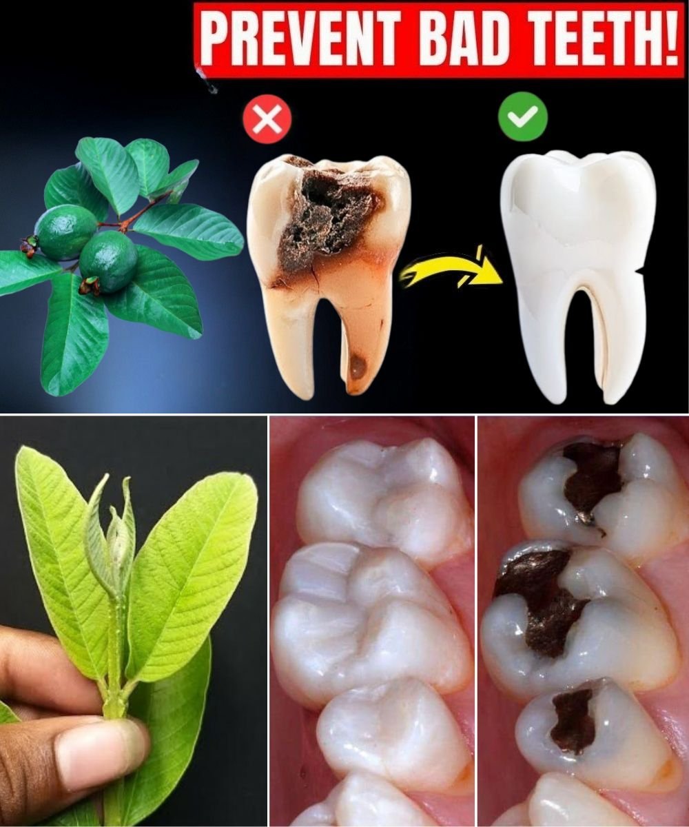 Top 3 Ways to Treat Tooth Decay with Guava Leaves – Simple and Cost-Effective