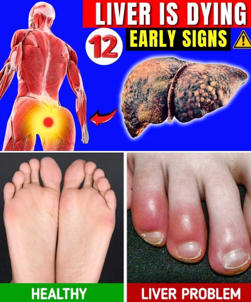 12 Early Signs Your Liver Is Dying: What Your Feet Reveal About Liver Health