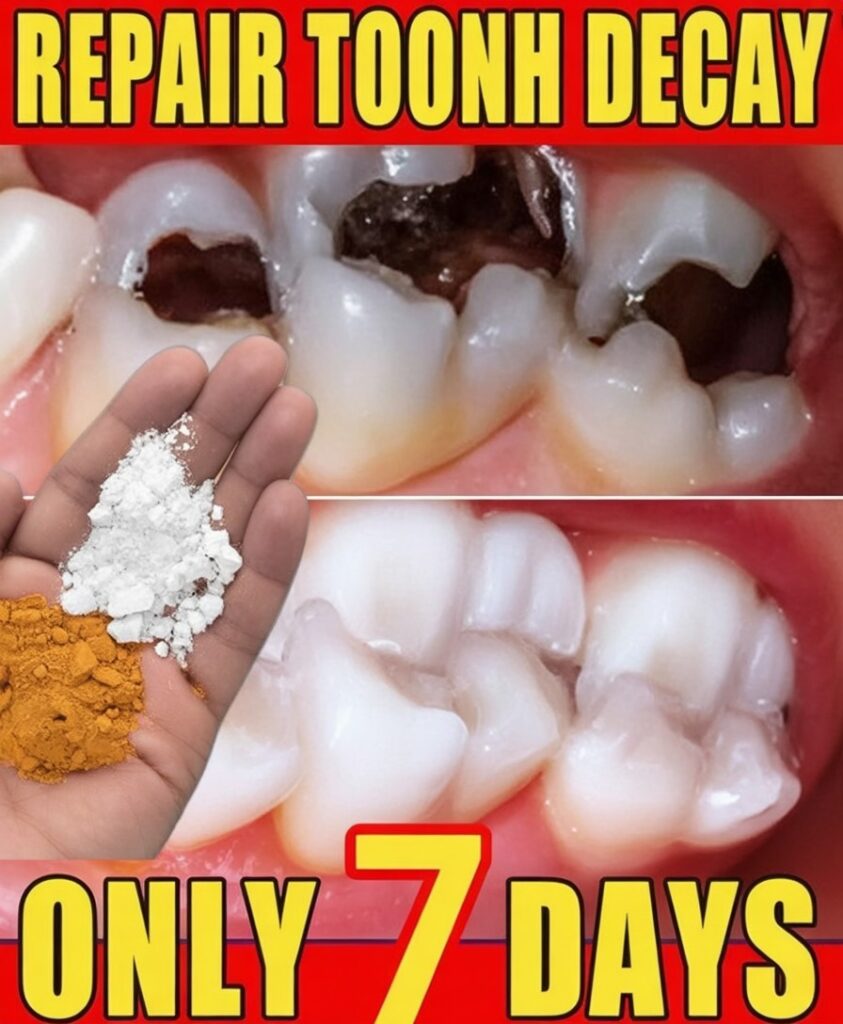 Fight Tooth Decay Naturally at Home
