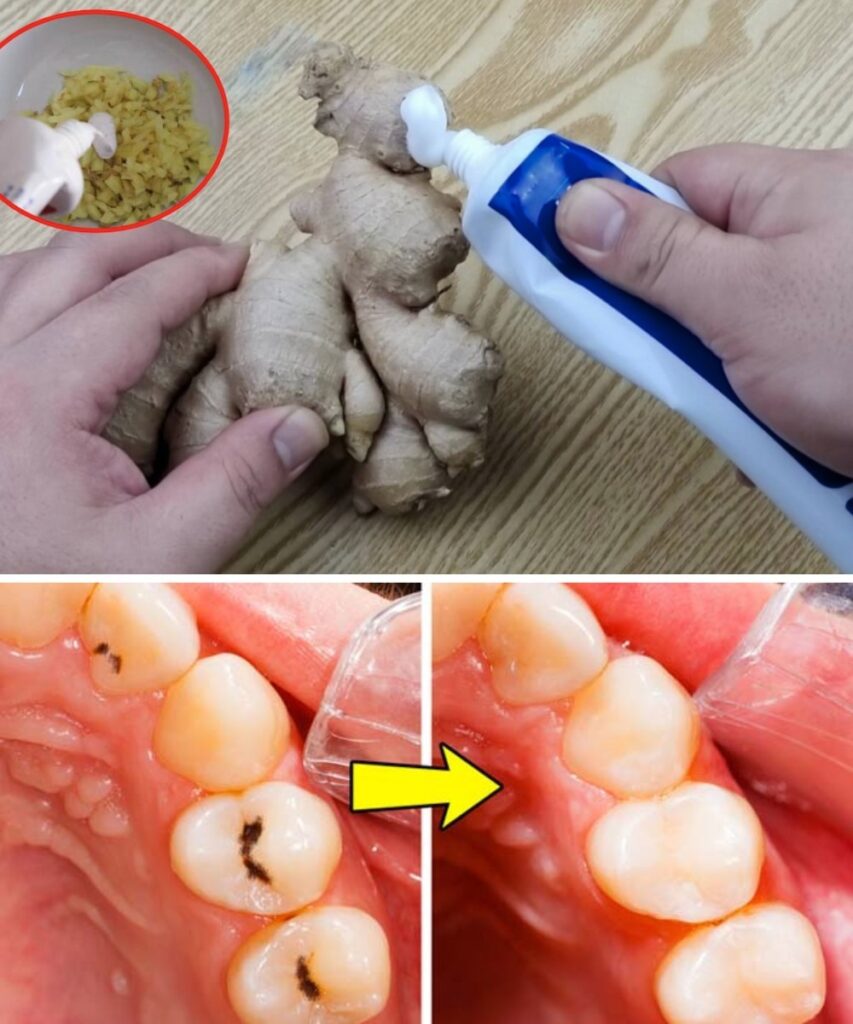 🌿 Natural Ways to Protect Your Teeth and Prevent Cavities